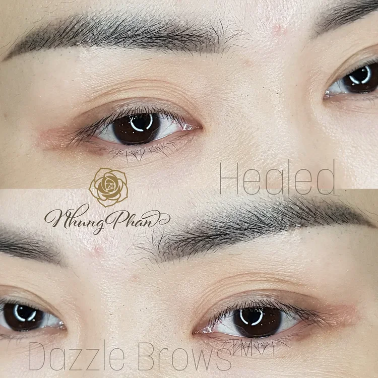 Brows