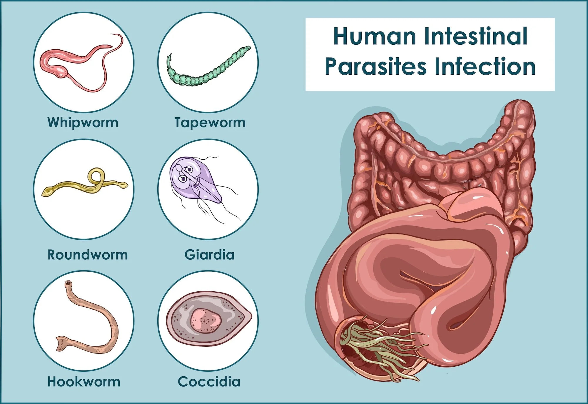 Parasites &amp; Your Health: How Hidden Infections May Contribute to Chronic Symptoms