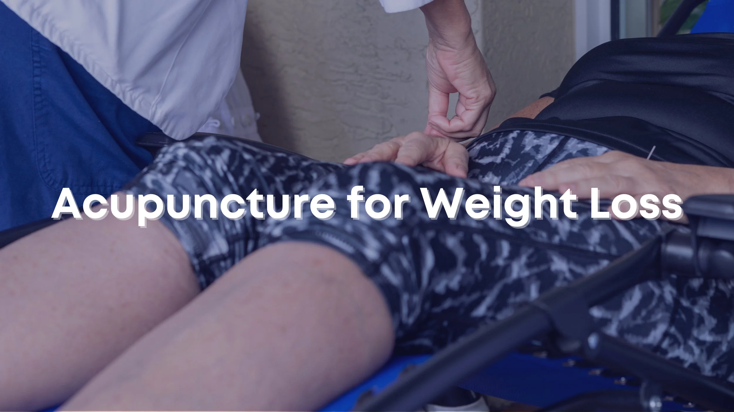 Acupuncture for Weight Loss – How Can It Help with Obesity in the US?