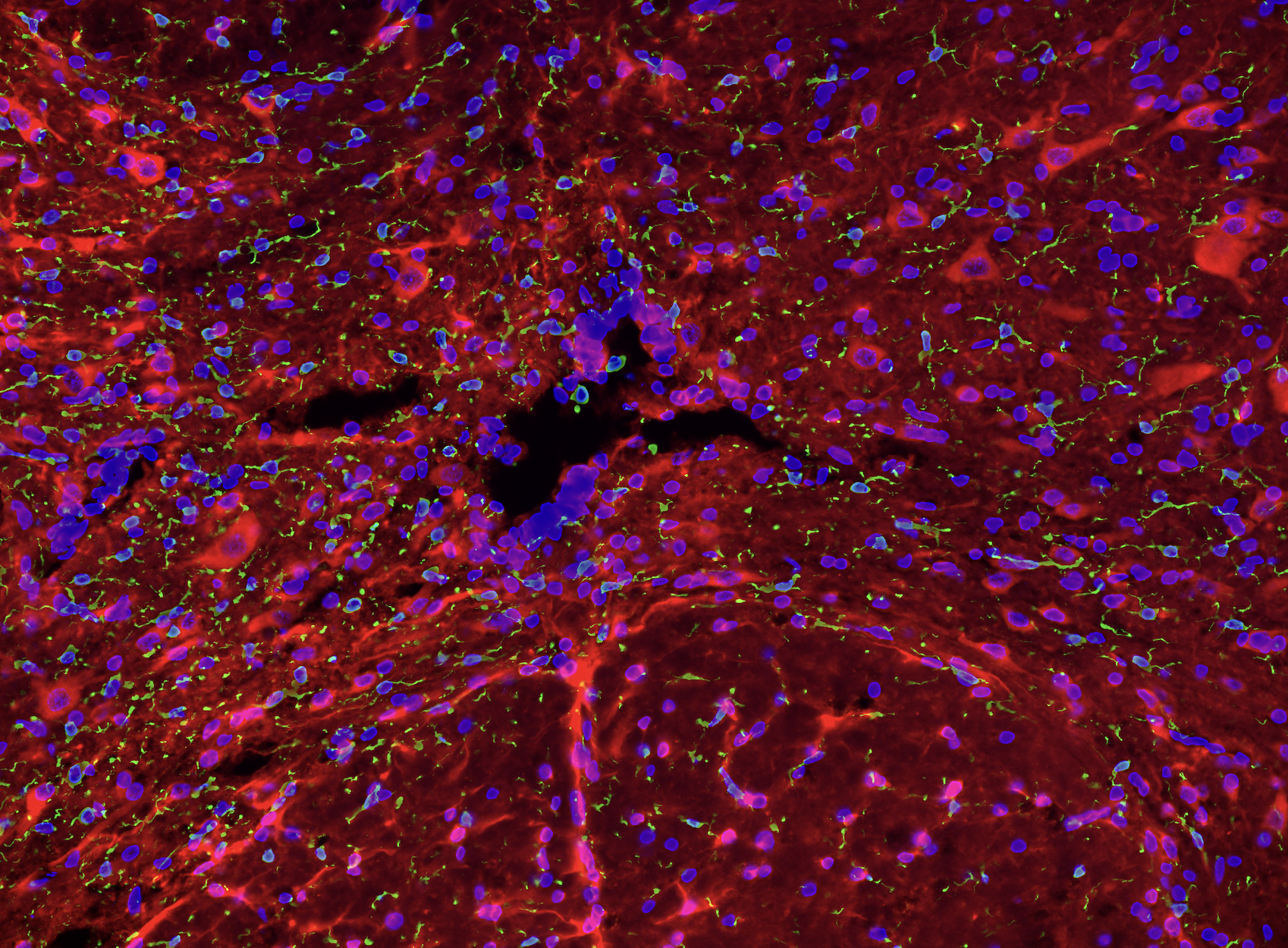 Microscopic view of cells with blue, green, purple, and red coloring illustrating a biological or medical sample.