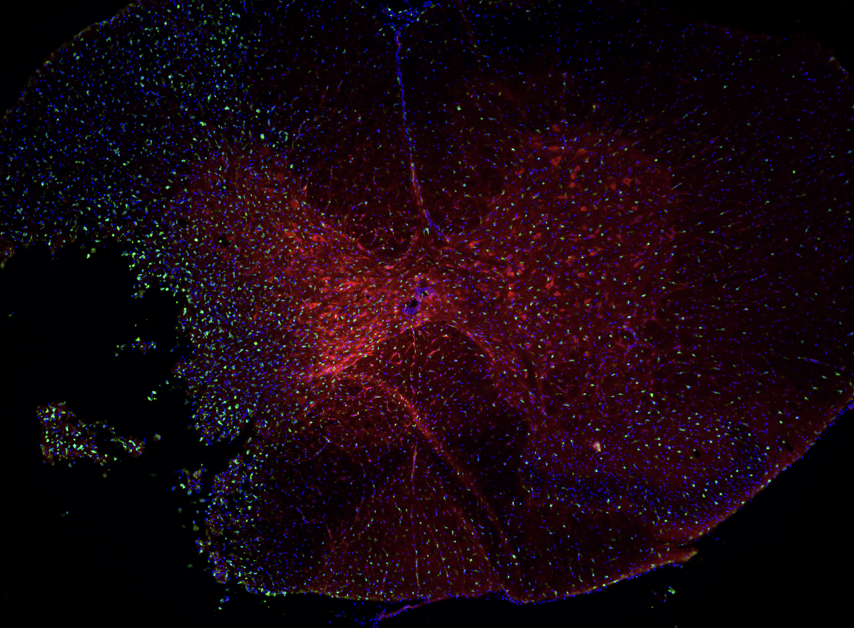 A fluorescent microscopy image showing neurons with red, blue, and green labels highlighting different structures or proteins, set against a black background.