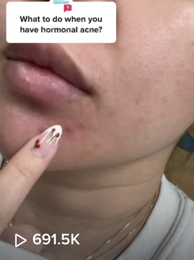 FEATURES & BENEFITS | @BYEBYEBLEMISH