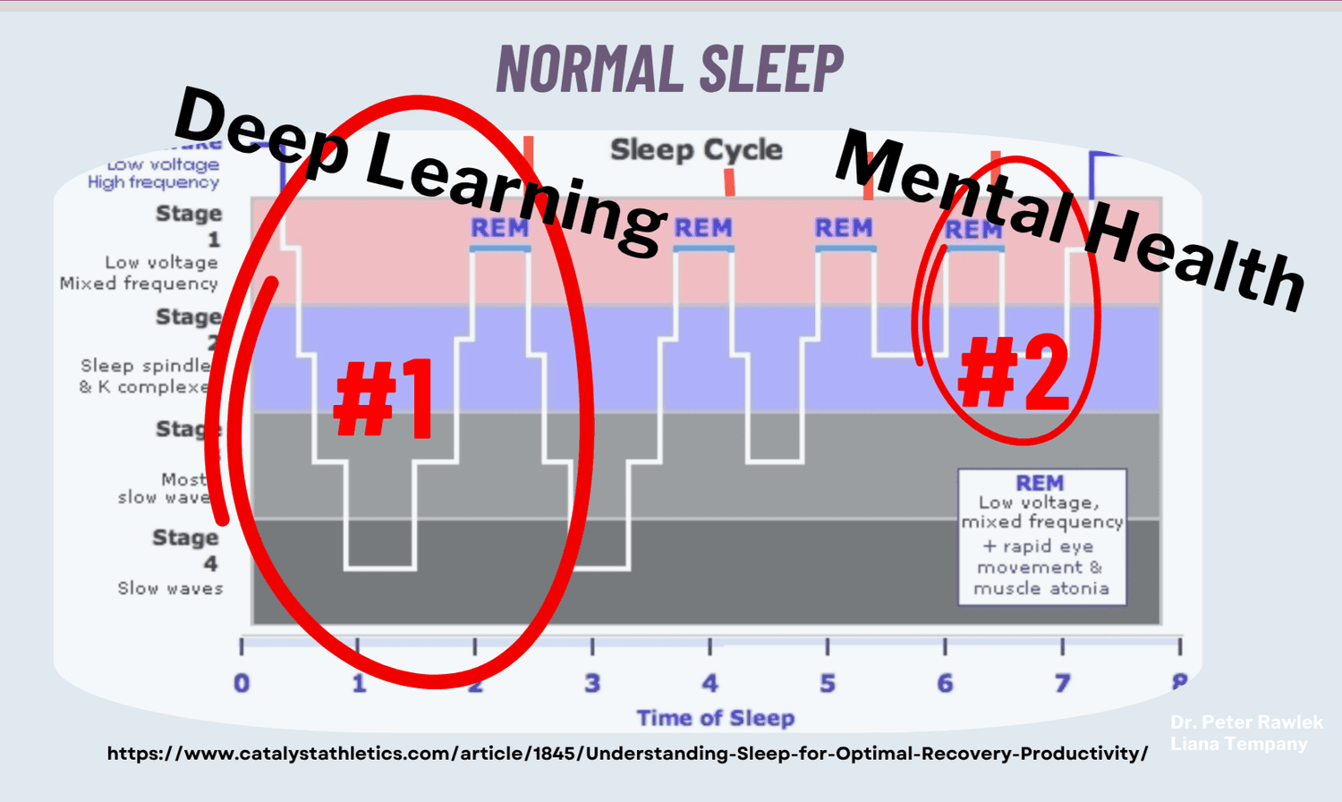 REM cycle of sleep