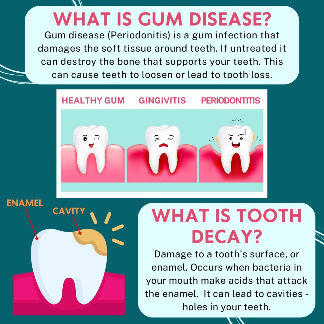 Did you know that nearly half (46%) of all adults aged 30 years or older show signs of gum disease?

&iquest;Sab&iacute;a que casi la mitad (46%) de todos los adultos de 30 a&ntilde;os o m&aacute;s muestran signos de enfermedad de las enc&iacute;as?