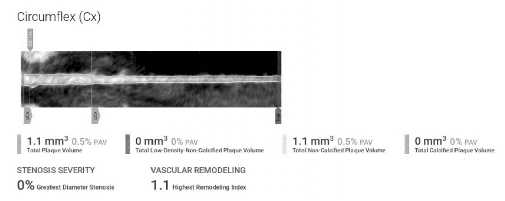 Kayla-Barnes-Lentz-Circumflex-Results.png