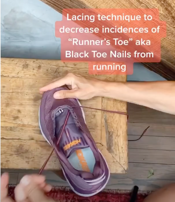 BLOODY TOES? RUNNER'S TOE?
