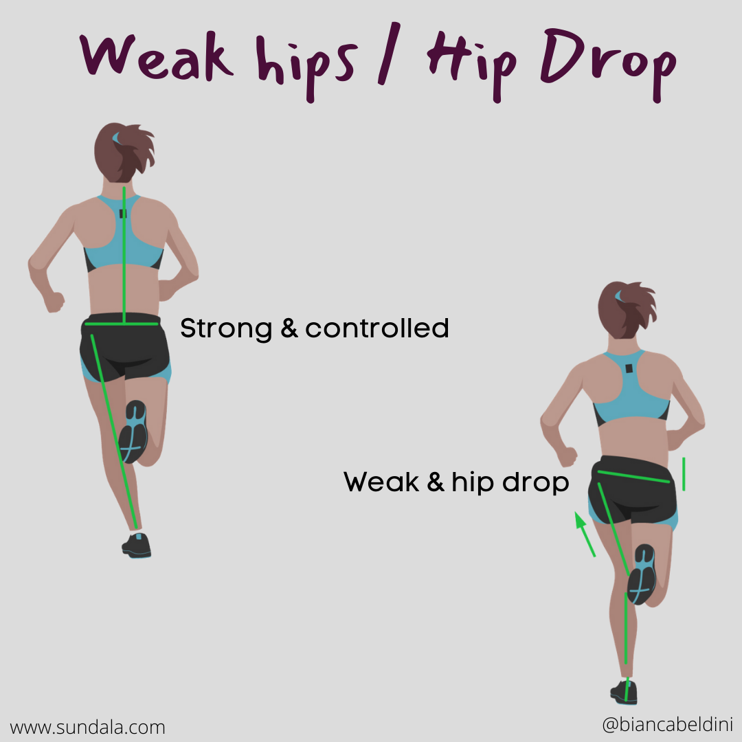 weak hips hip drop sundala nyack acupuncture .png