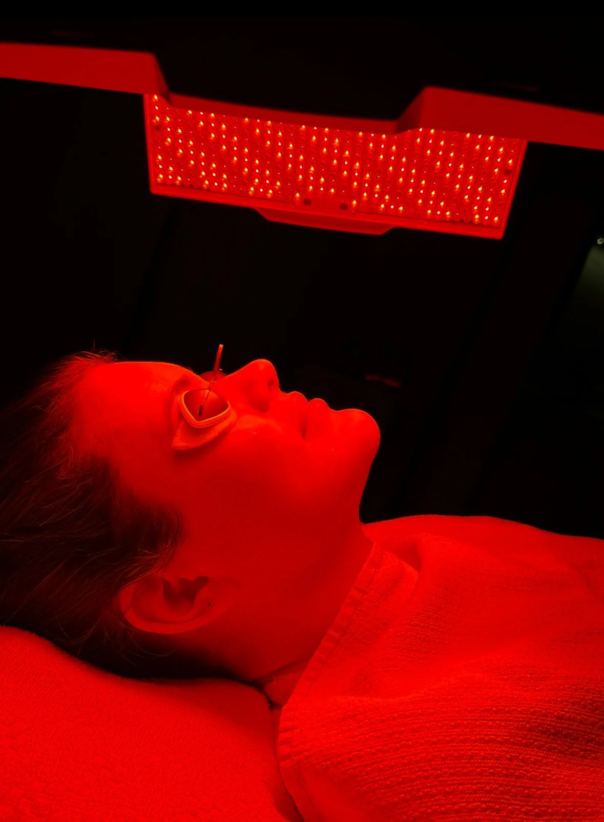 Radiant Skin Unveiled: The Transformative Power of LED Light Therapy