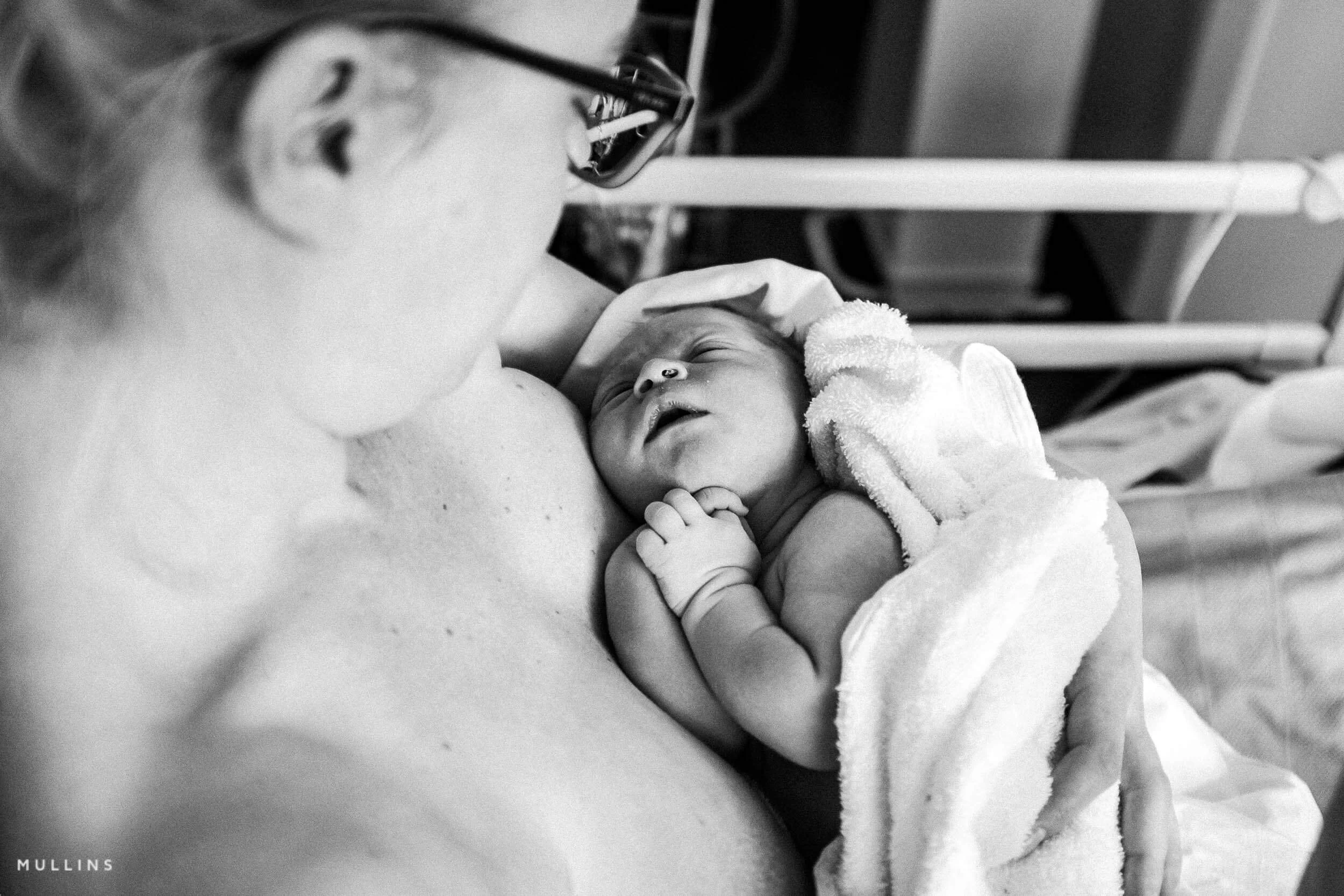 C-section birth photography in London