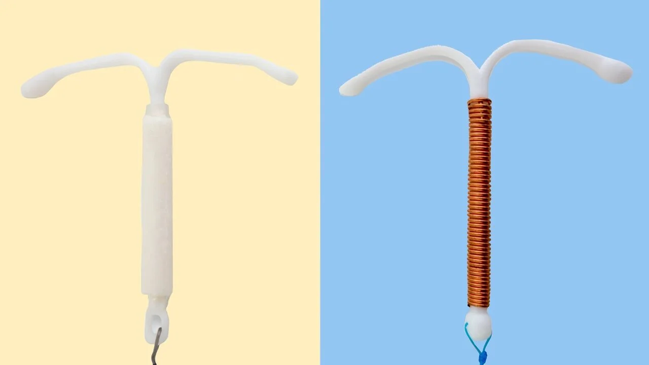 IUD-Types.jpeg
