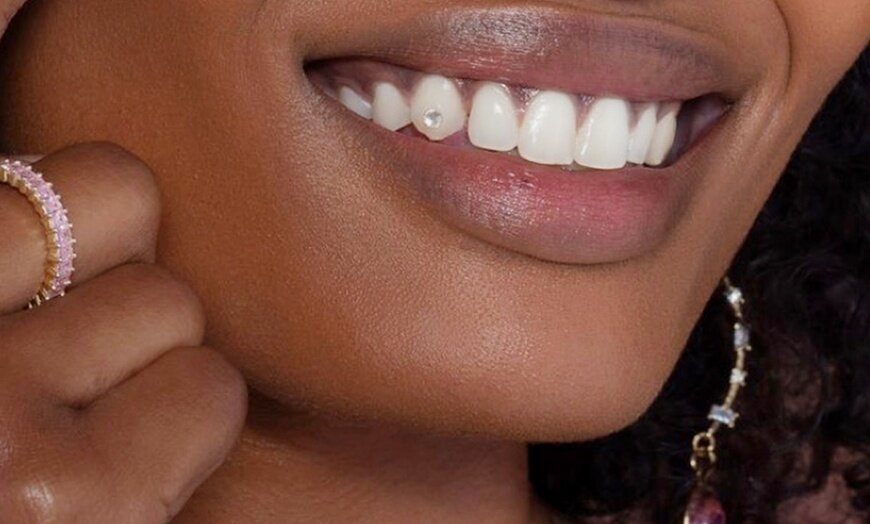 Tooth Gems - Dental Trends — Bronze Beauties Beauty Bar