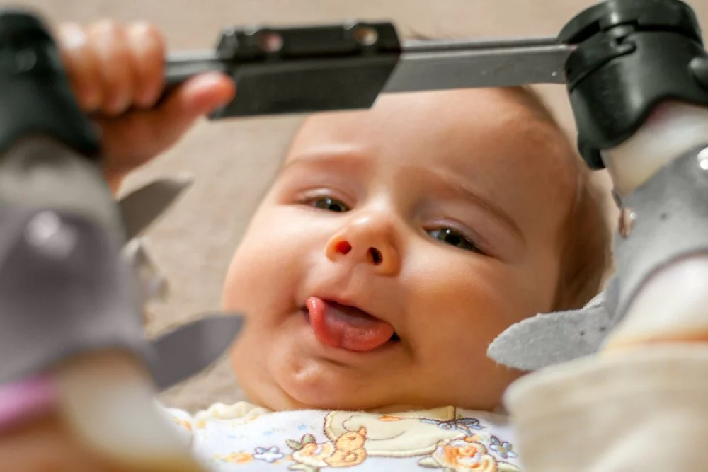 Tongue-Tie In Babies and Potential Treatment Areas