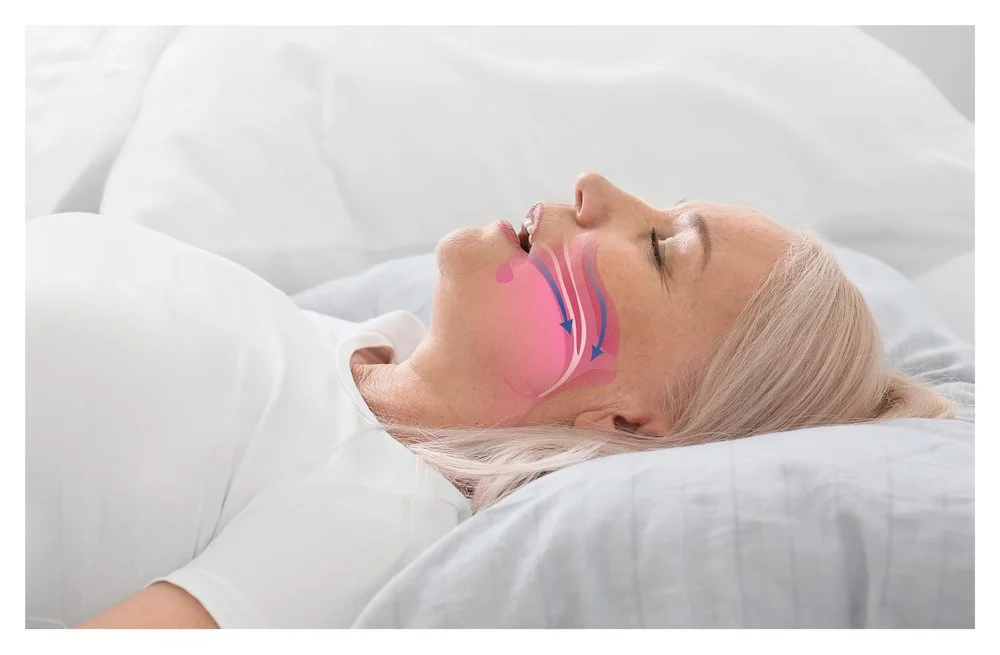 Sleep Apnea Causes and Its Treatment