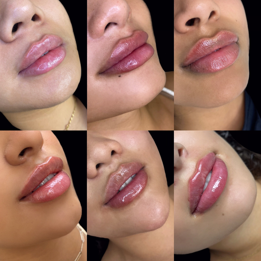 Advanced Lip Training with Nurse Joan