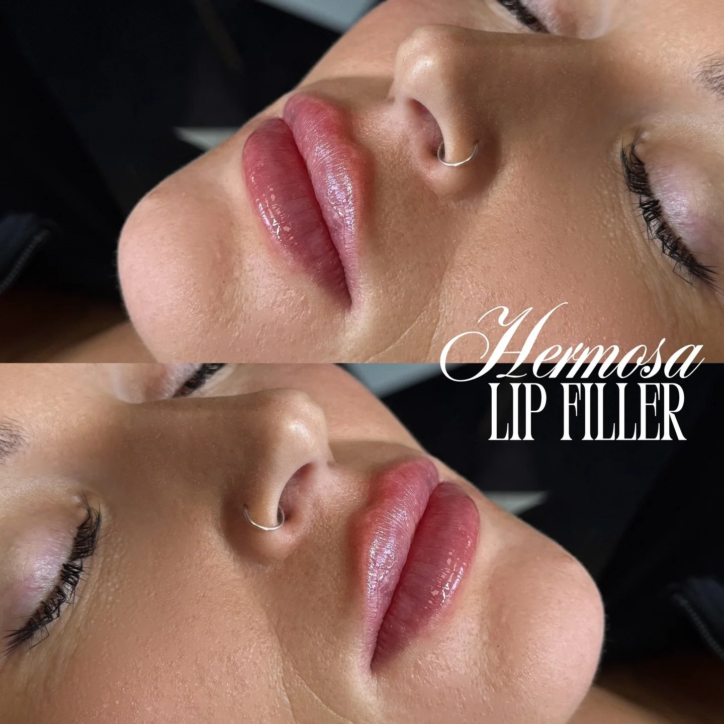 LIPS TO LOVEEEE 💗👄

@injectorsof MARCH PROMO $285 HALF SYRINGE ⭐️

Booking with Sofia available online  at the King City location✨