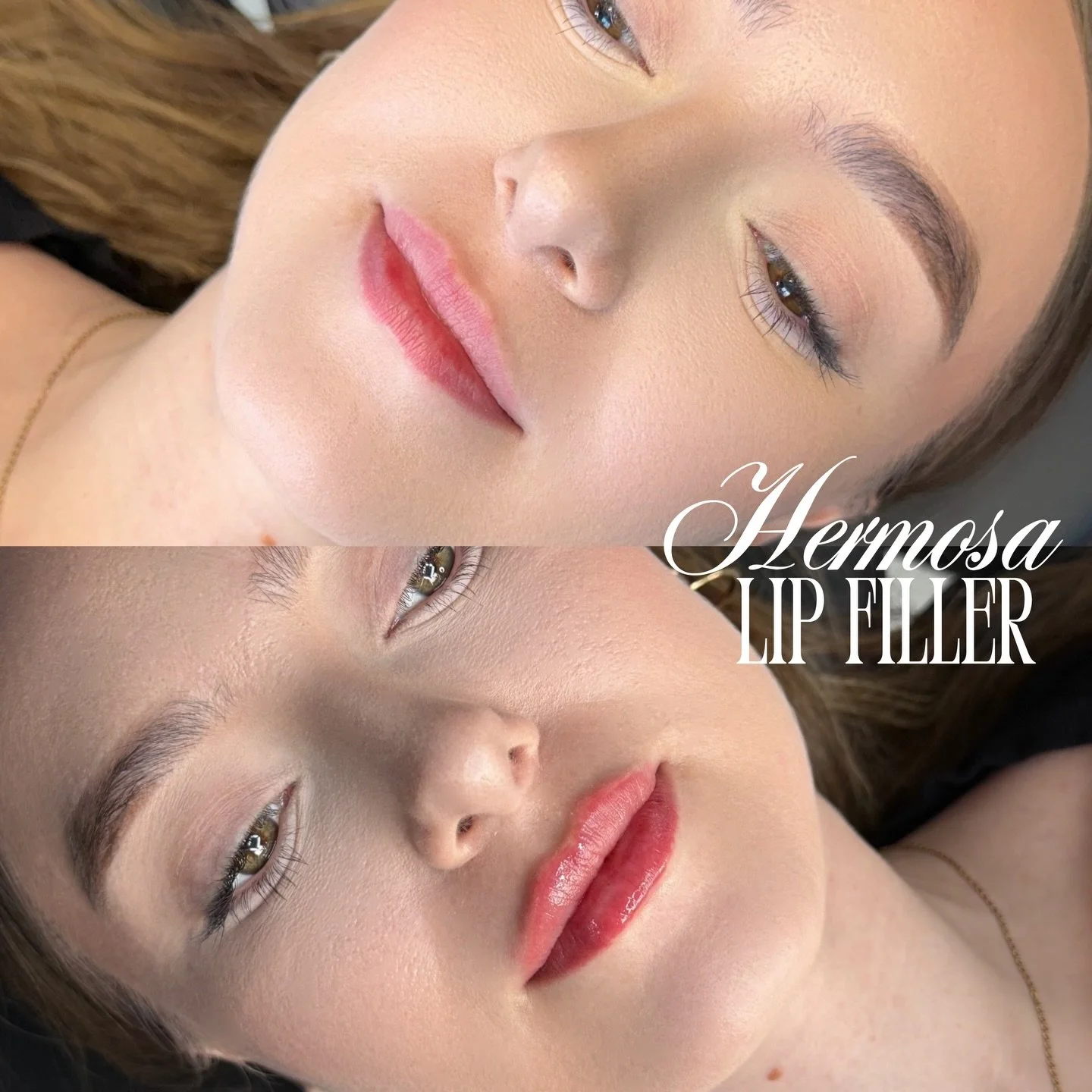 Natural beautiful shaped lips for the first time 👀💗

$285 half syringe promo exclusively with @injectorsof 

BOOKING WITH NURSE SOFIA AVAILABLE ONLINE⭐️✨