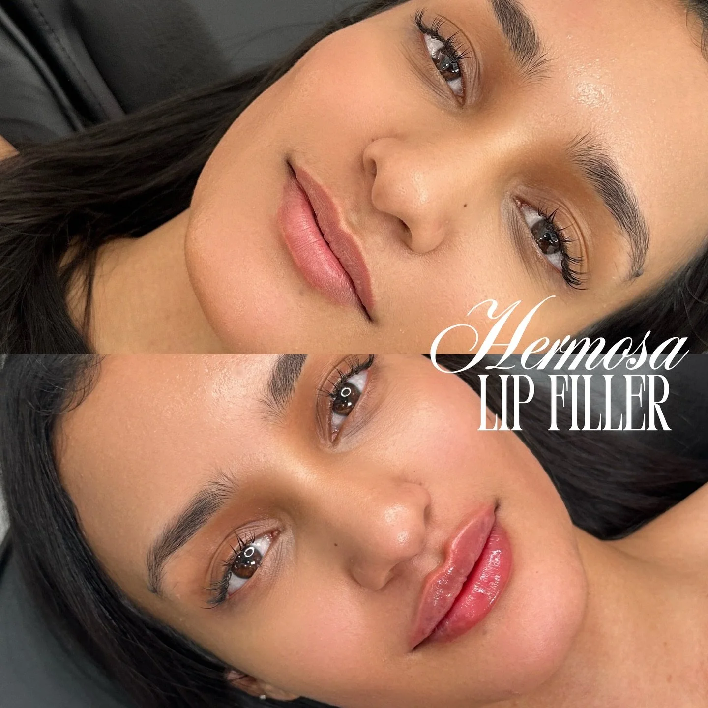 GET HERMOSA-FIED, TALL FLAT CONTOURED LIPS ✨⭐️

Booking available online for all locations 💌✨