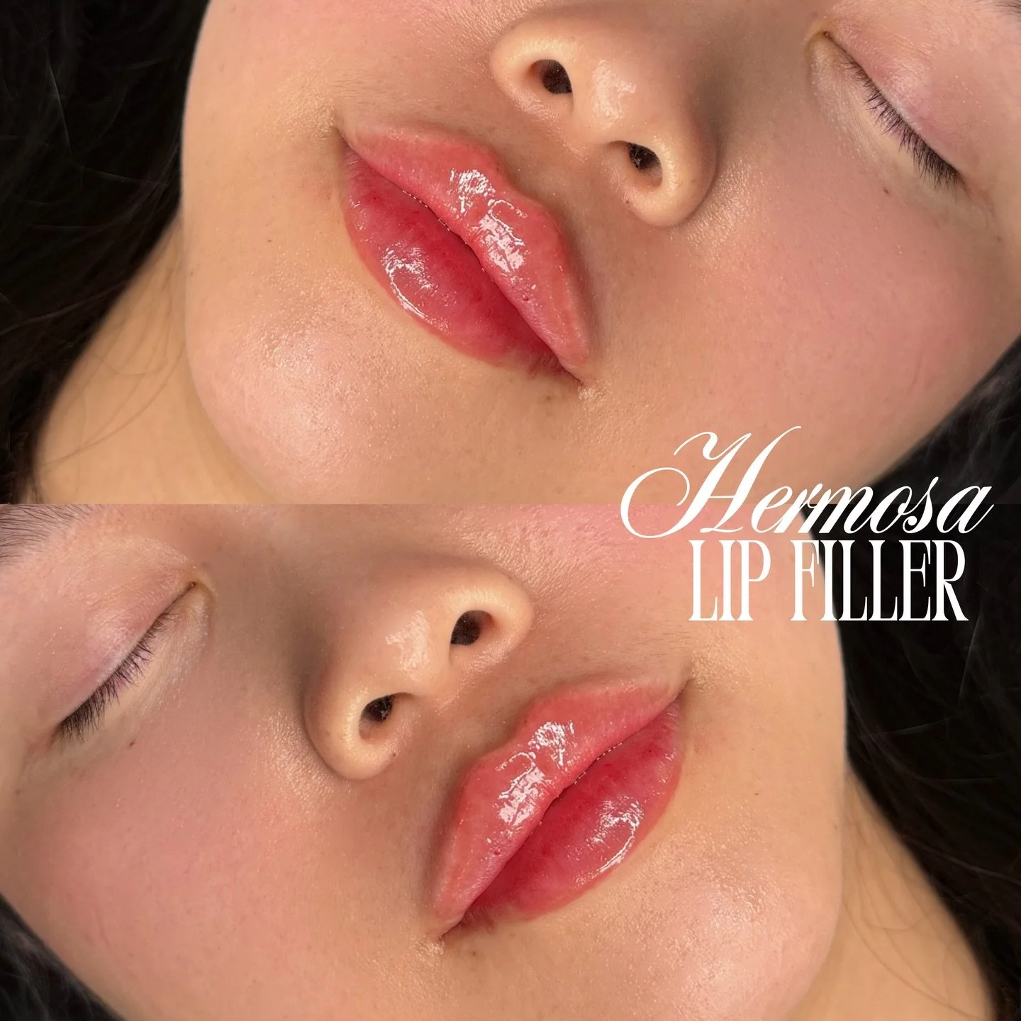 WE LOVE A JUICY CONTOURED LIP💛

Booking with @injectorsof available online for the king location exclusively ⭐️