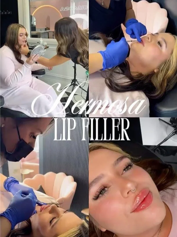 Lip filler starts with a consultation 💉✨

Not just lips&hellip; but balance, structure, and your natural beauty 💖
Every face is different &mdash; that&rsquo;s why we take the time to assess your lip shape, proportions, and goals before touching a s