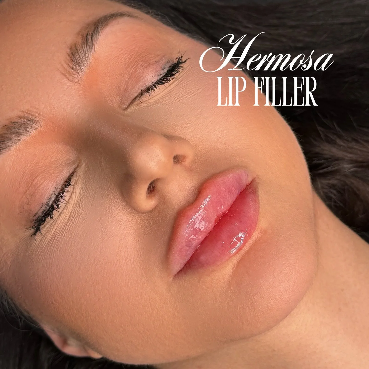 CENTRAL JUICY TALL LIPS AS REQUESTED 👀✨

$285 half syringe promo with Nurse Sof ONLY⭐️

Booking with @injectorsof available online exclusively at the King location 💌