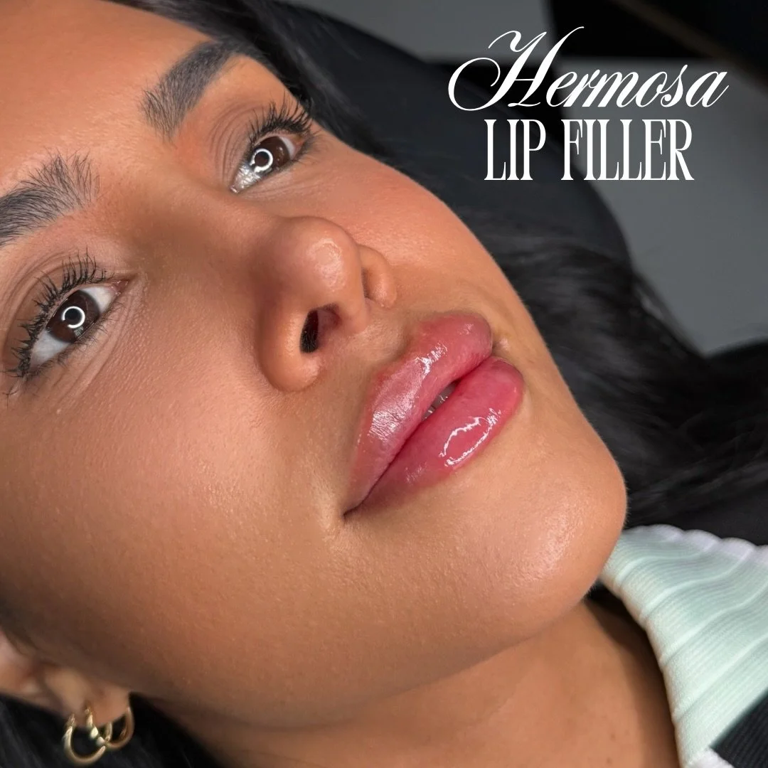 Lip filler for Easter? Say less 🐣🌸💐

Booking with @injectorsof available online ✨ King City location exclusively 

BOOK THROUGH LINK IN BIO
$285 HALF SYRINGE LIP FILLER
$399 SKIN BOOSTER
$7 UNIT DYSPORT

#lips #lipfillers #nurse #nurseinjector