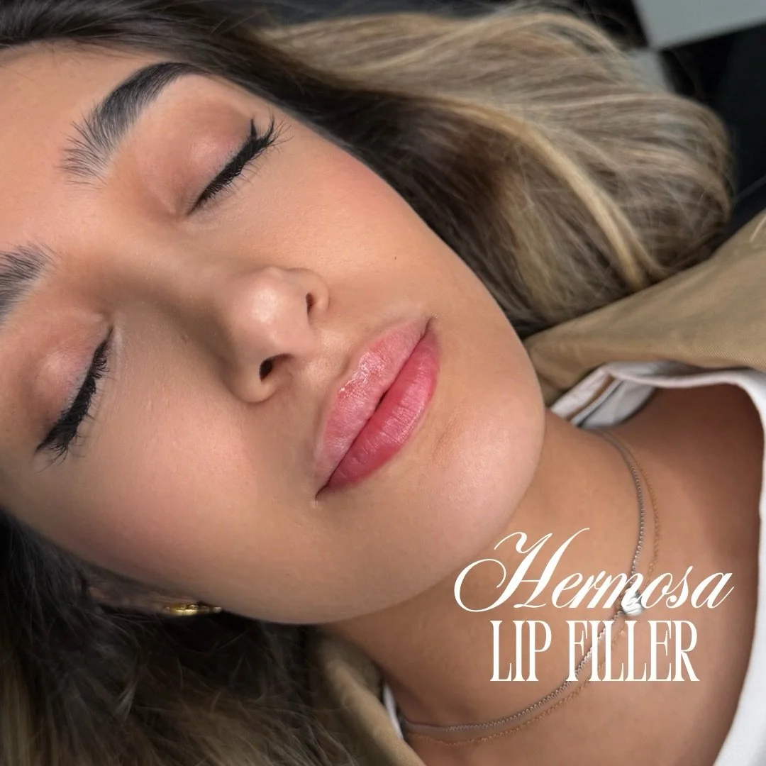 Soft, natural, and still you ✨ This client requested for soft natural lips 

Swipe for a before and after 💉

Enhancing your lips, not changing them &mdash; because balance is everything 💋

Online booking available with @injectorsof 

BOOK THROUGH L