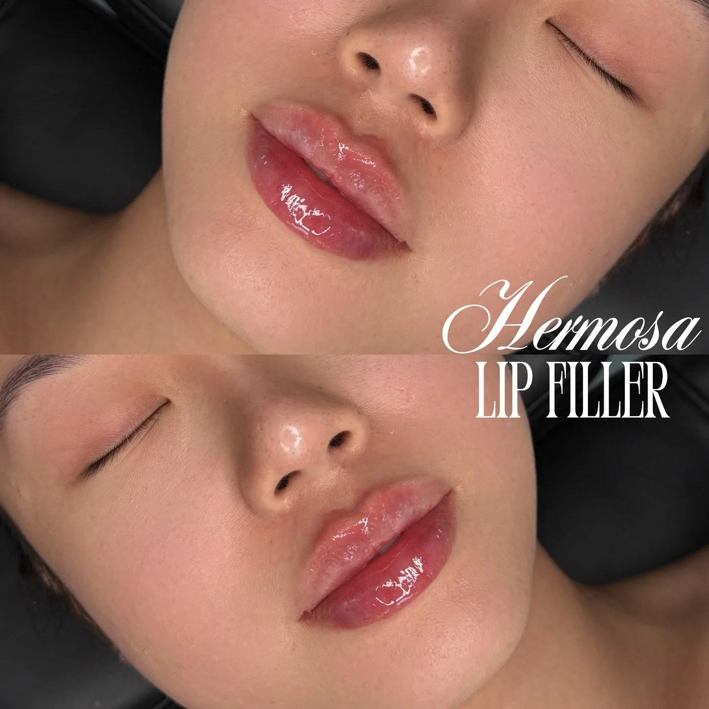 WE LOVE A FRESH POUTY LIP 💗🎀

Booking with Nurse Sofia available at the King location 💌