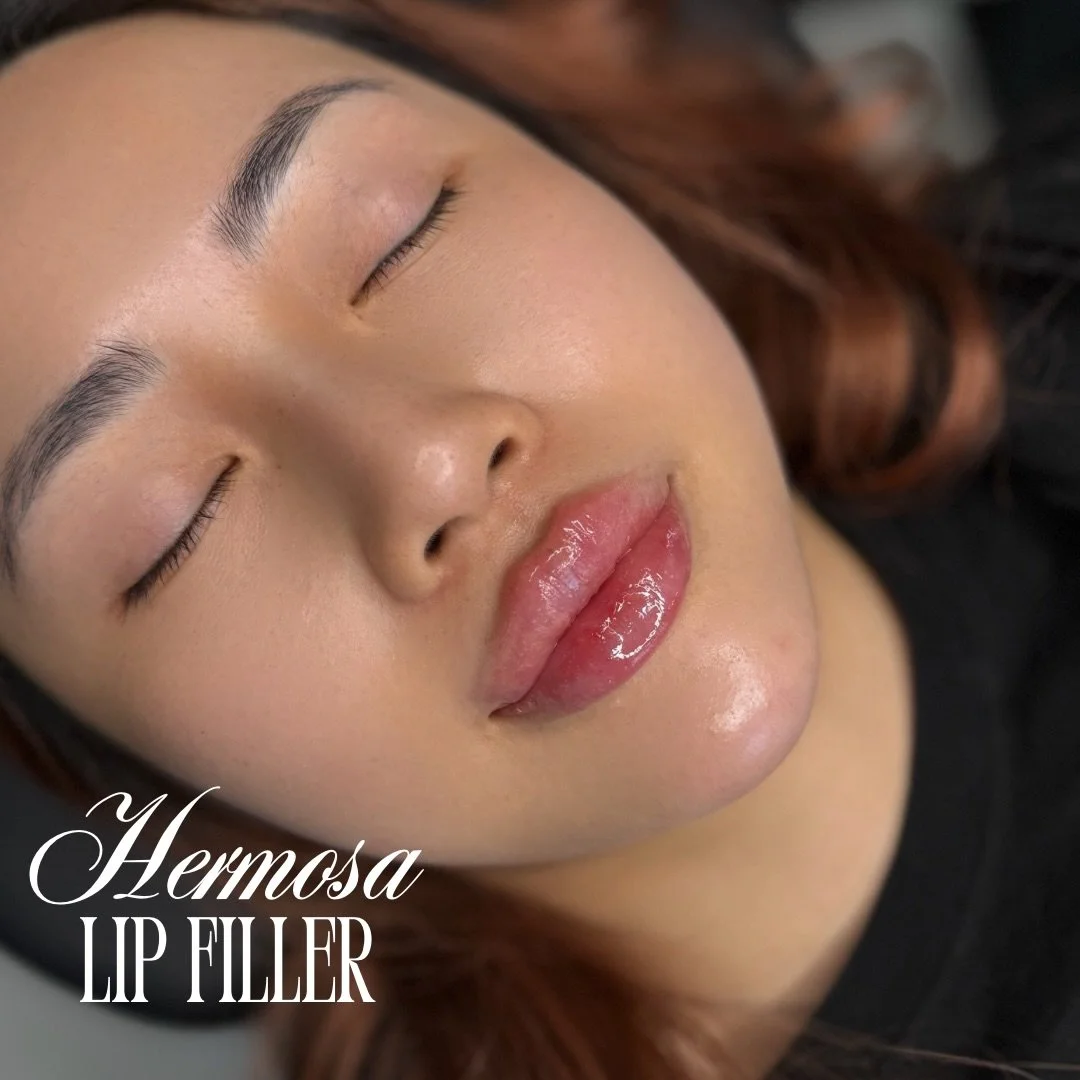 Confidence starts with how you feel 💖
The lips are just the bonus

Swipe to see her before and after 💉
Booking with @injectorsof available online

BOOK FOR APRIL PROMO
$285 HALF SYRINGE 💉
$399 SKIN BOOSTER ✨
$7/unit DYSPORT

#lips #lipfillers #par