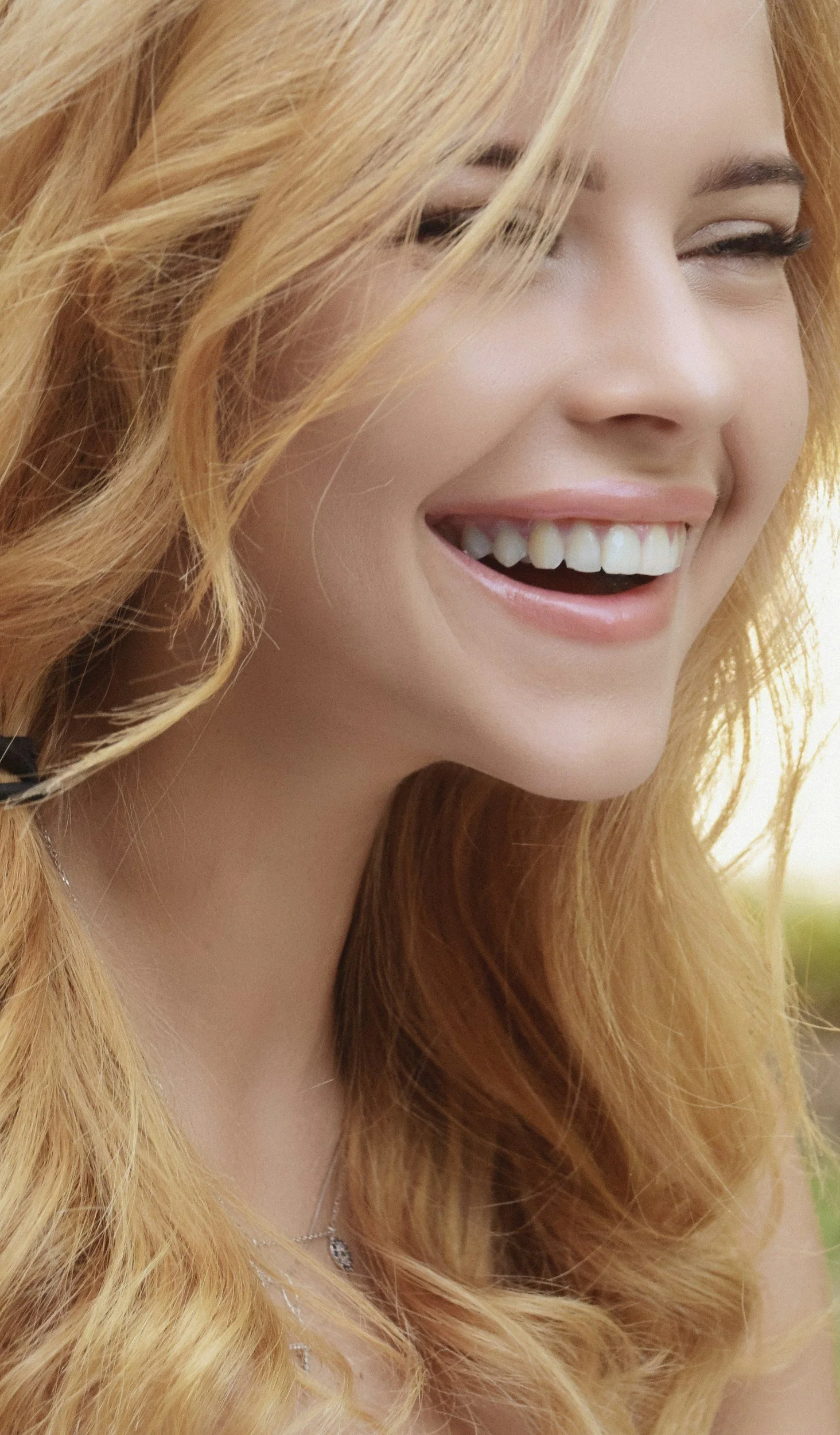 Teeth Whitening - Vohra DDS