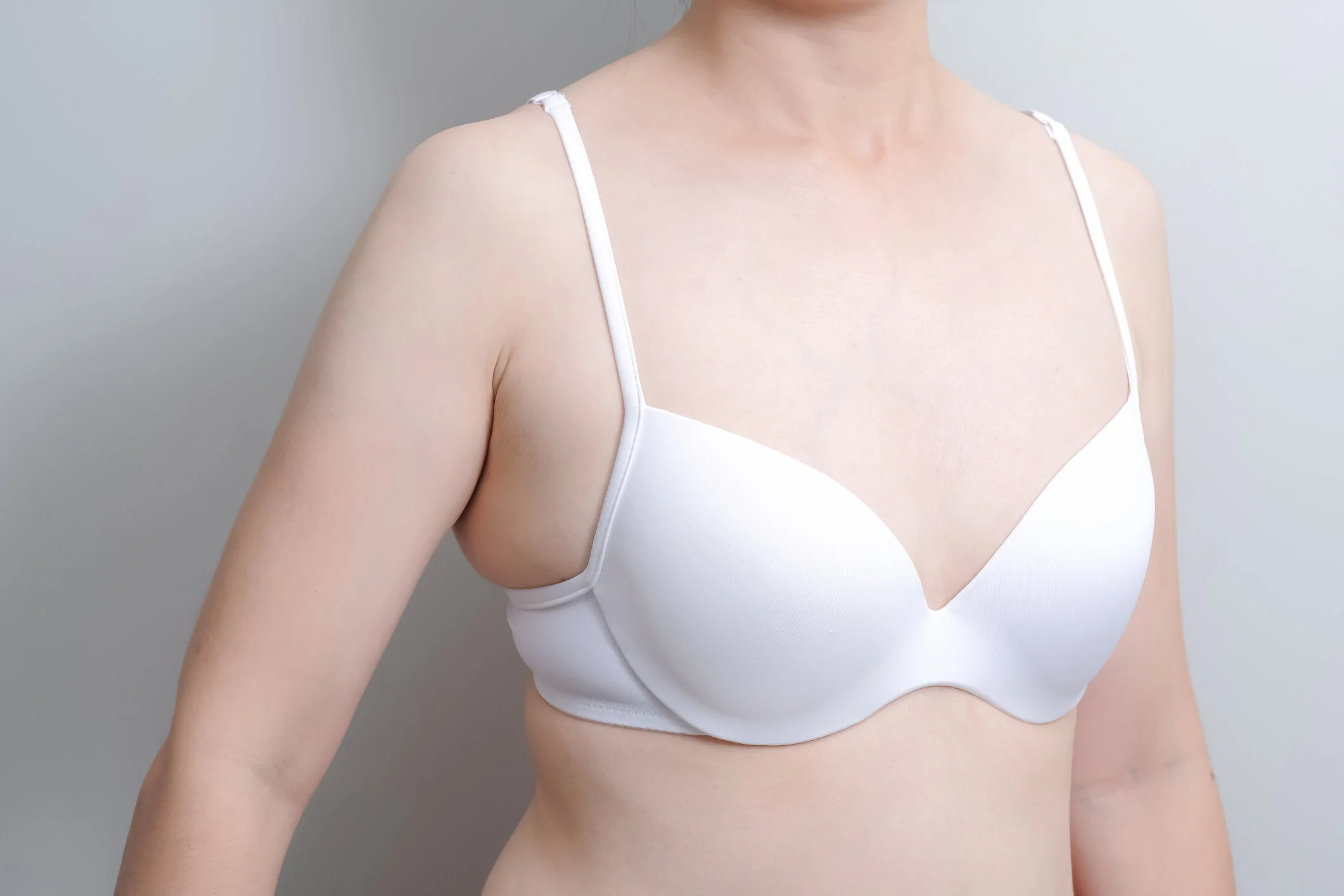 副乳是甚麼？應如何解決煩人的副乳問題？