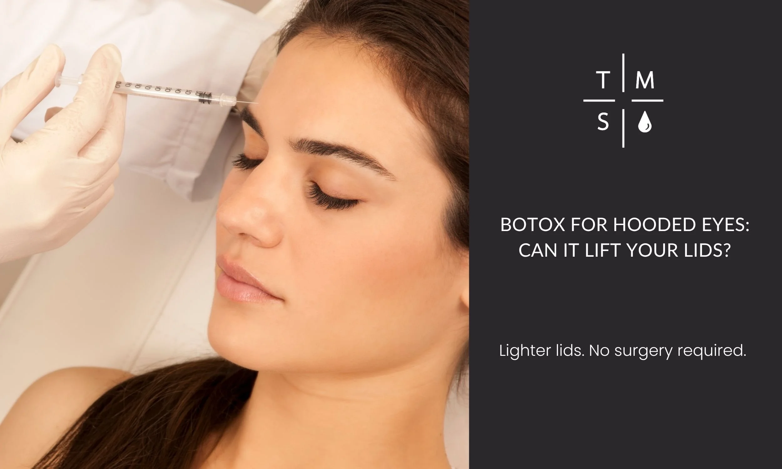 Botox for Hooded Eyes: Can It Lift Your Lids?