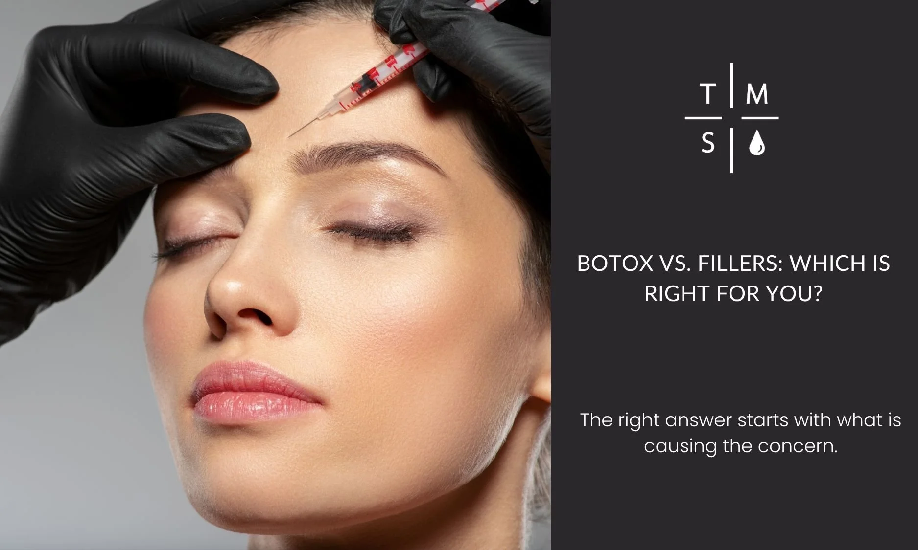 Botox vs. Fillers: Which Is Right for You?