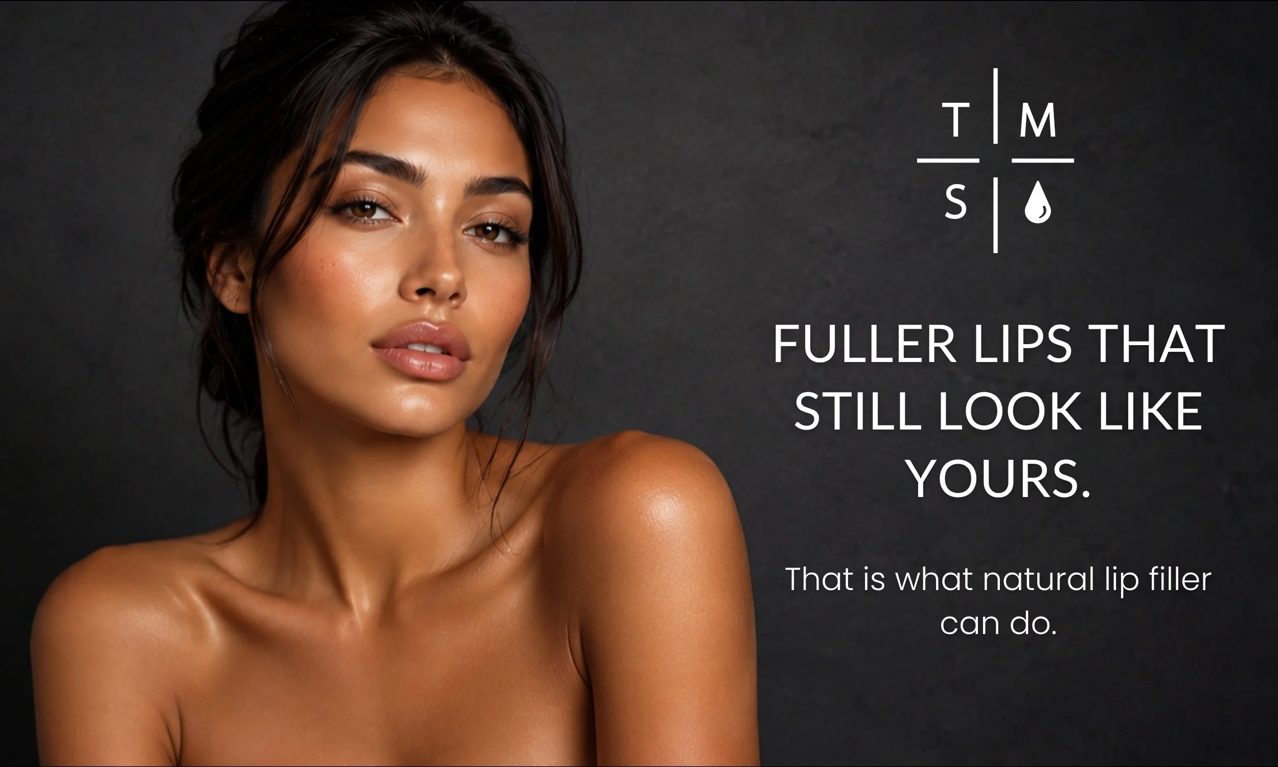 natural look with lip filler