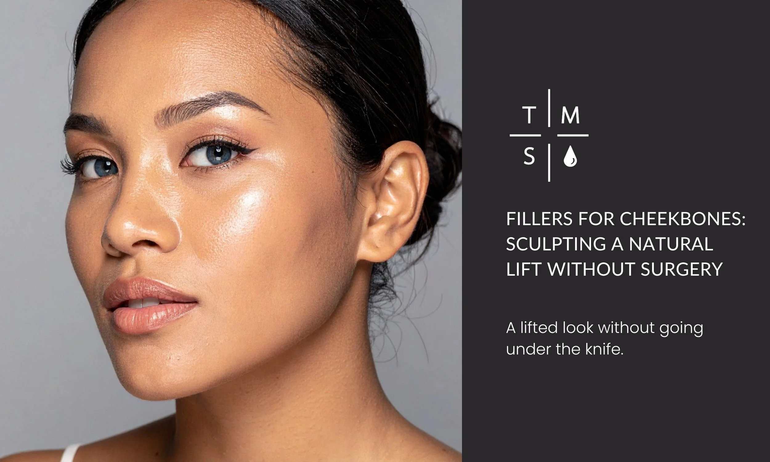 Fillers for Cheekbones: Sculpting a Natural Lift Without Surgery