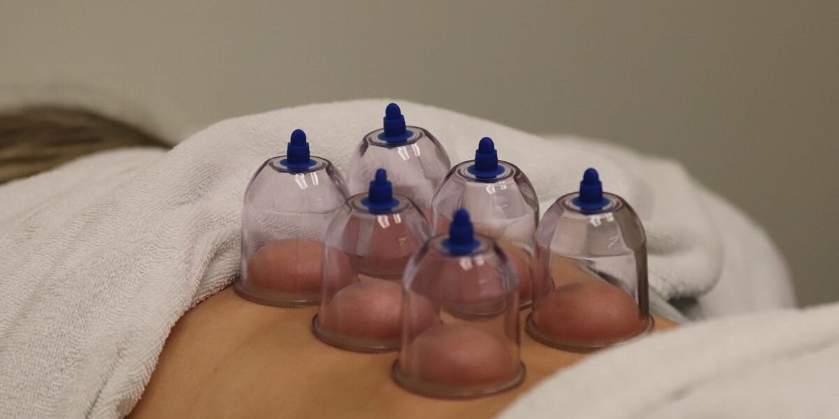 Cupping therapy treatment for muscle recovery in Dripping Springs, TX