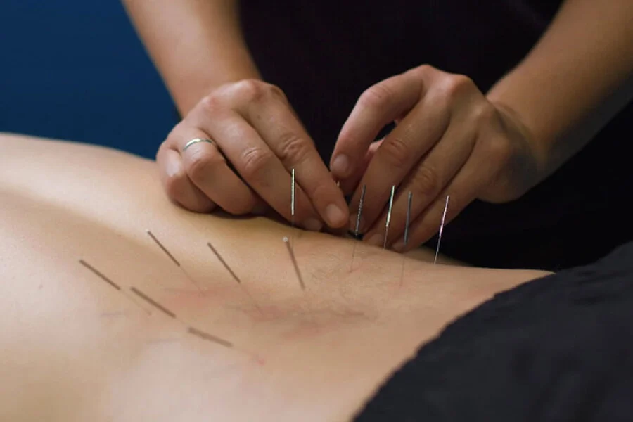Chiropractor performing dry needling therapy at Evolve Chiropractic in Dripping Springs