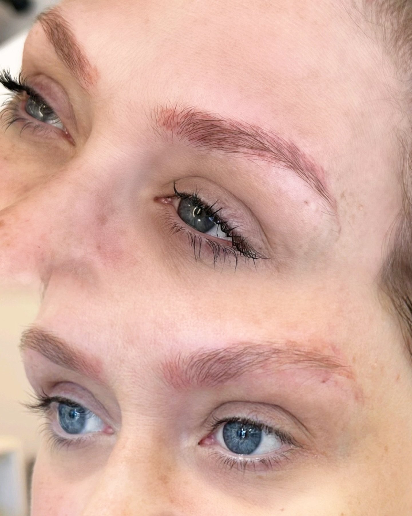 Permanent makeup REMOVAL 🔥 

We removed old work preformed by another artist. This is a great option for those who are unhappy with the results of their permanent makeup. Whether you&rsquo;re dissatisfied with the shape, color, or symmetry this remo