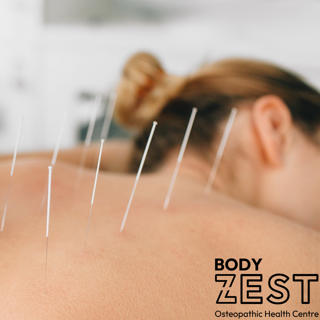 Dry Needling vs Acupuncture: What’s the Difference and Which One Is Right for You?