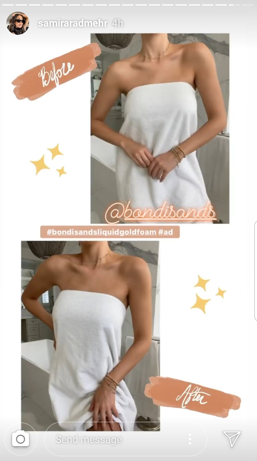 bondisands_beforeandafter.jpg