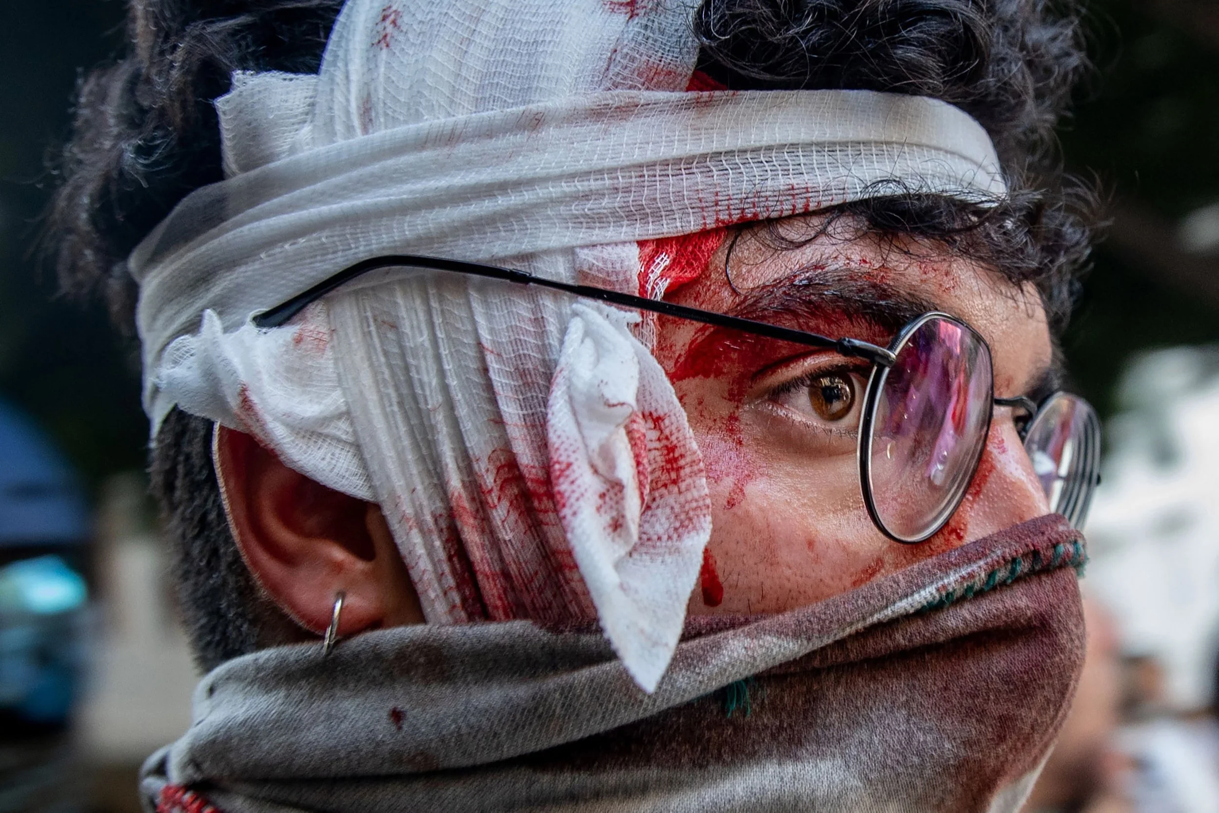 Close-up of a person wearing glasses, with bloodstains on the face, wrapped in cloth and bandages around the head and neck.