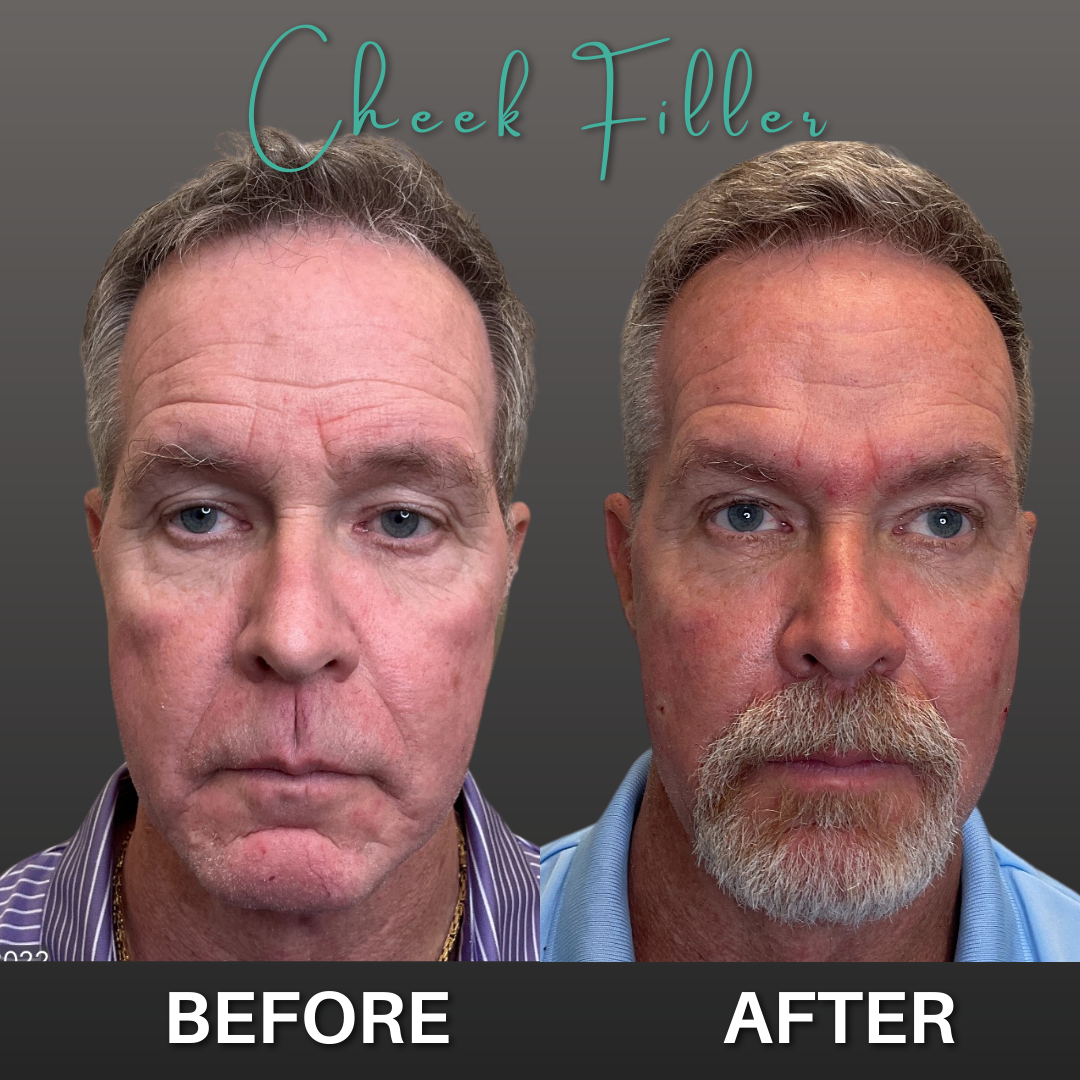 UPDATED B&A WEBSITE GALLARY.png