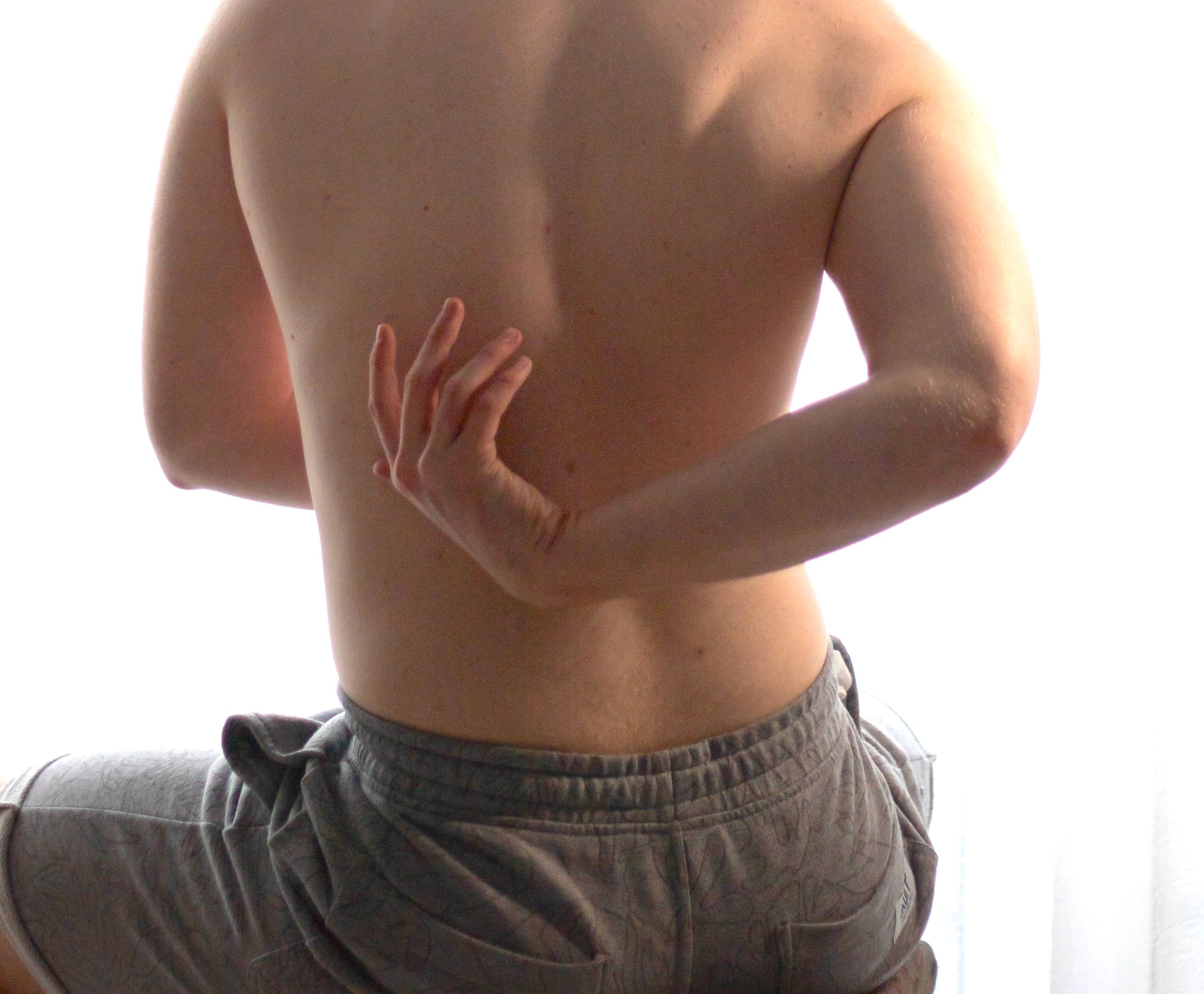 Can an osteopath help with sciatica?