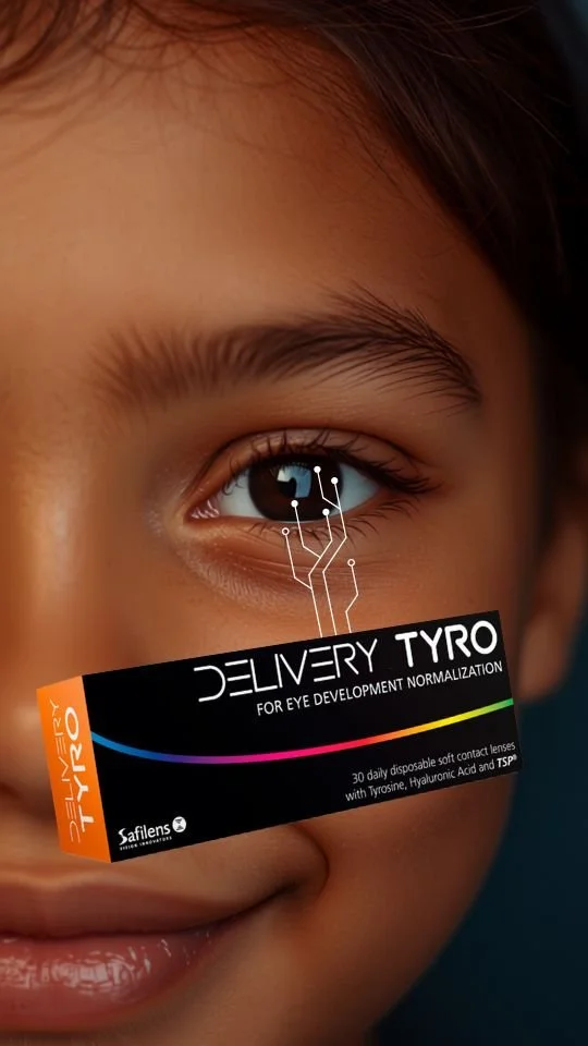 Delivery Tyro: le lenti a contatto che rallentano la miopia nei giovani