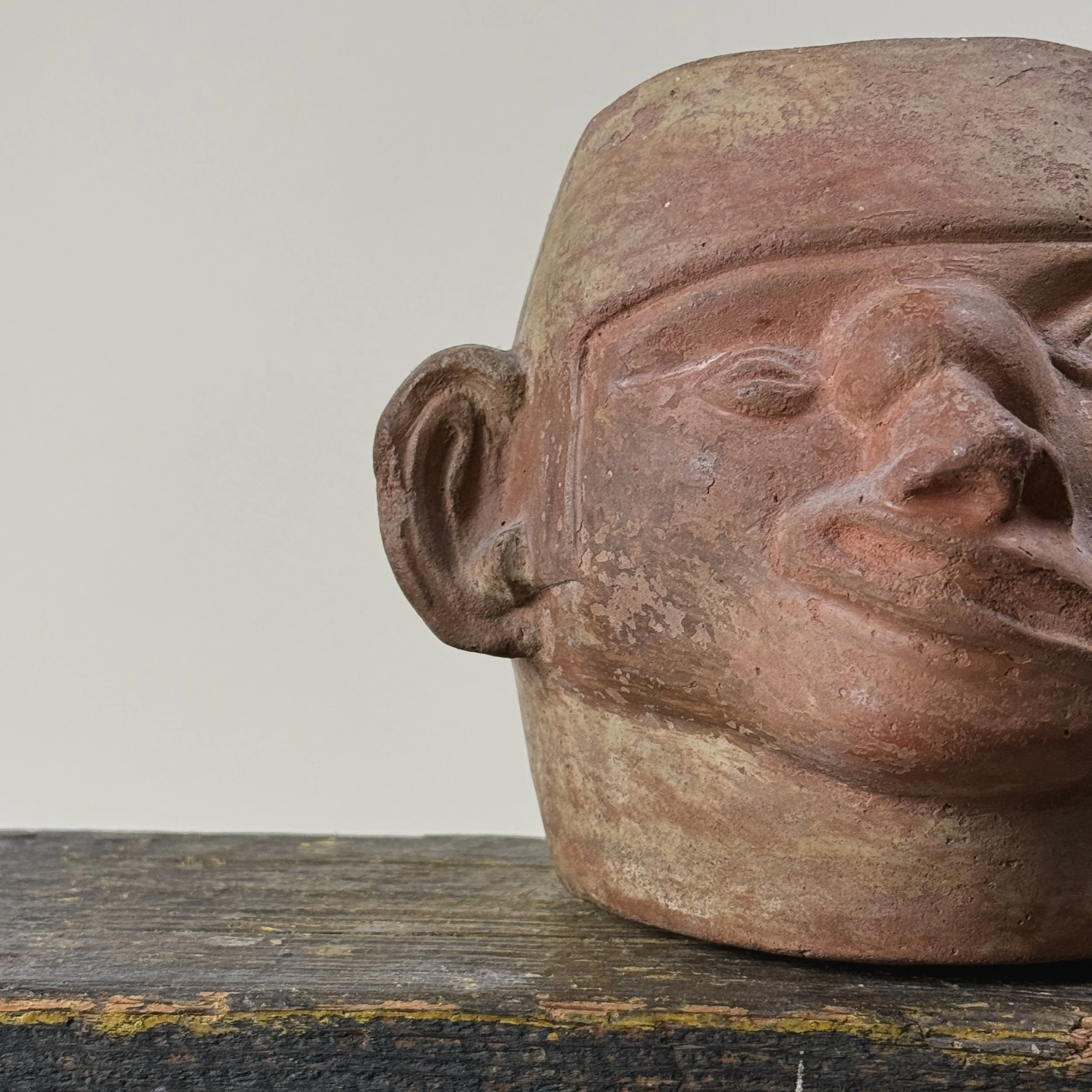 Detail of tumor at base of nose and facial paralysis