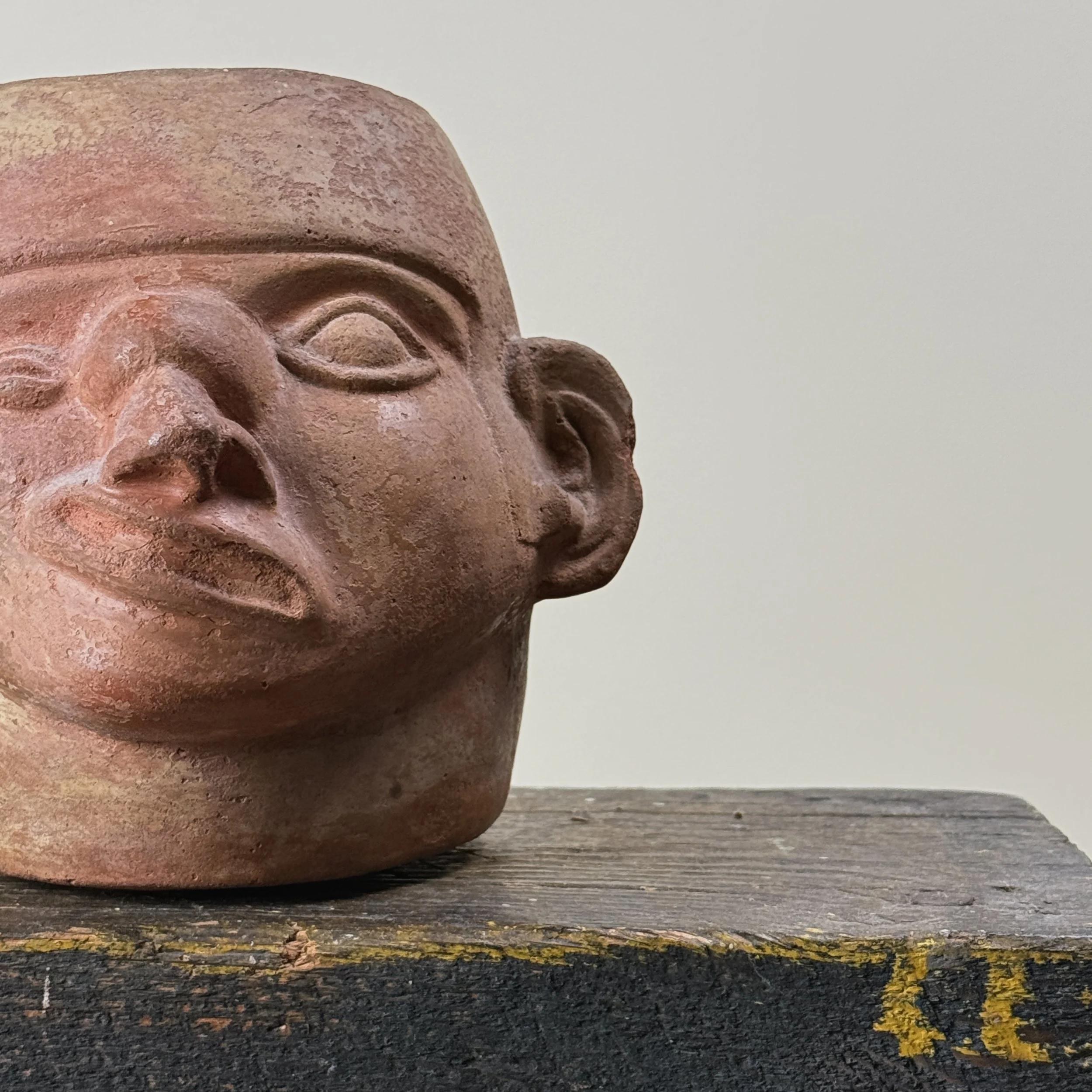 Detail of tumor at base of nose and facial paralysis