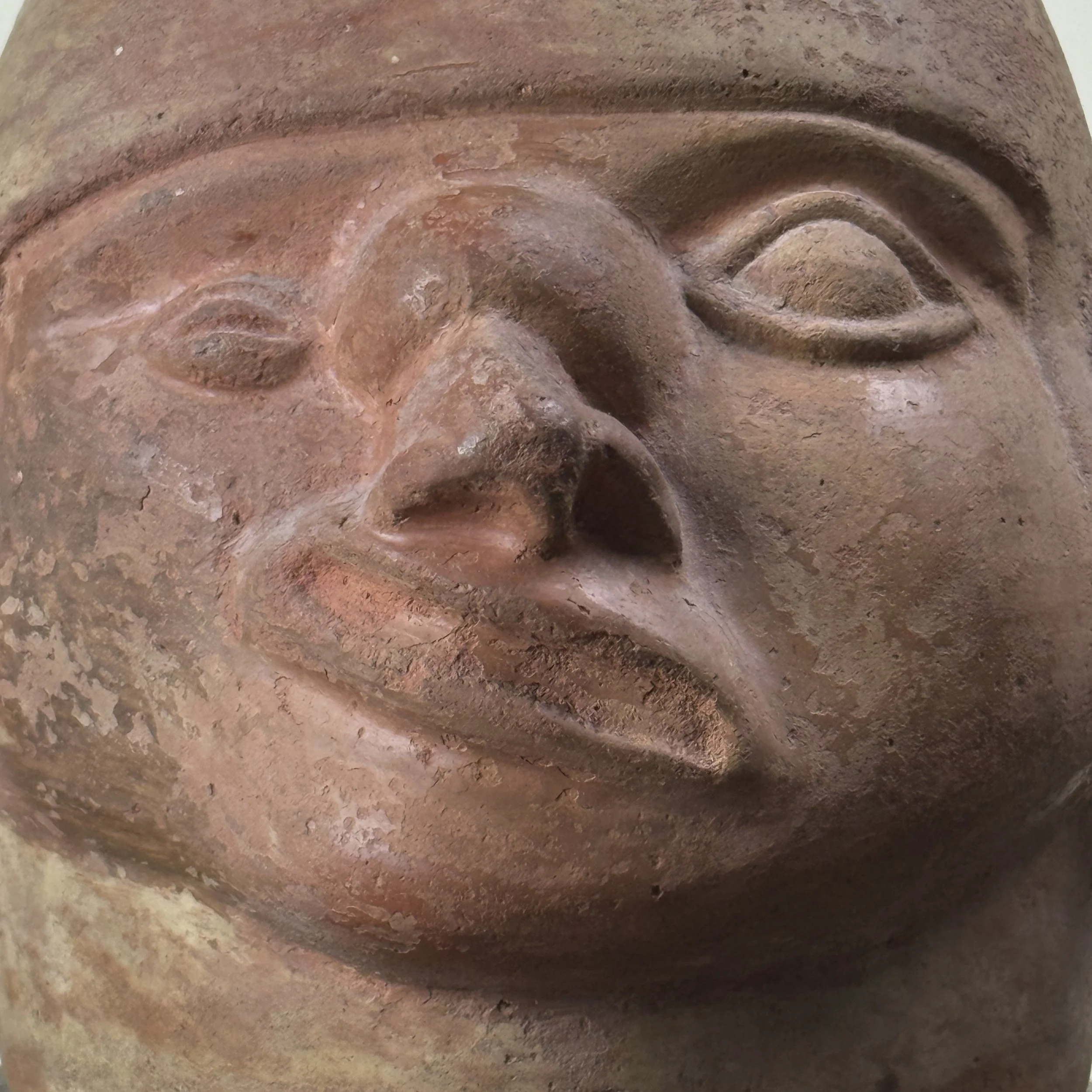Detail of tumor at base of nose and facial paralysis