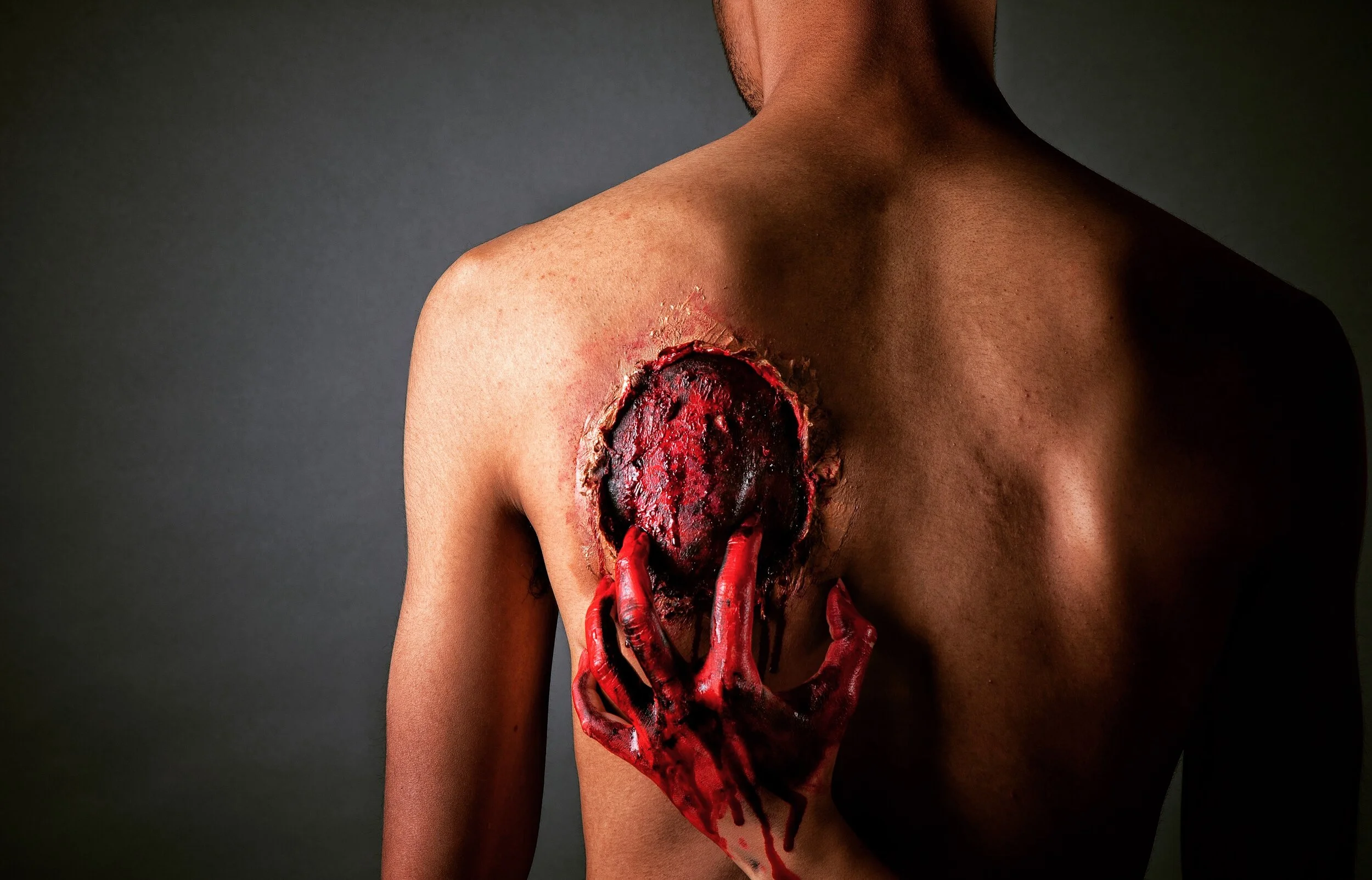 My Five Stages of Grief