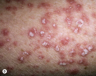 Dermatology Specialists of Kansas City