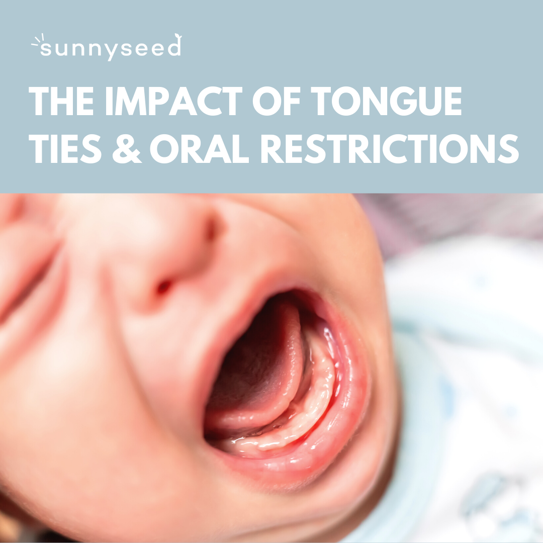 The Impact of Tongue Ties & Oral Restrictions