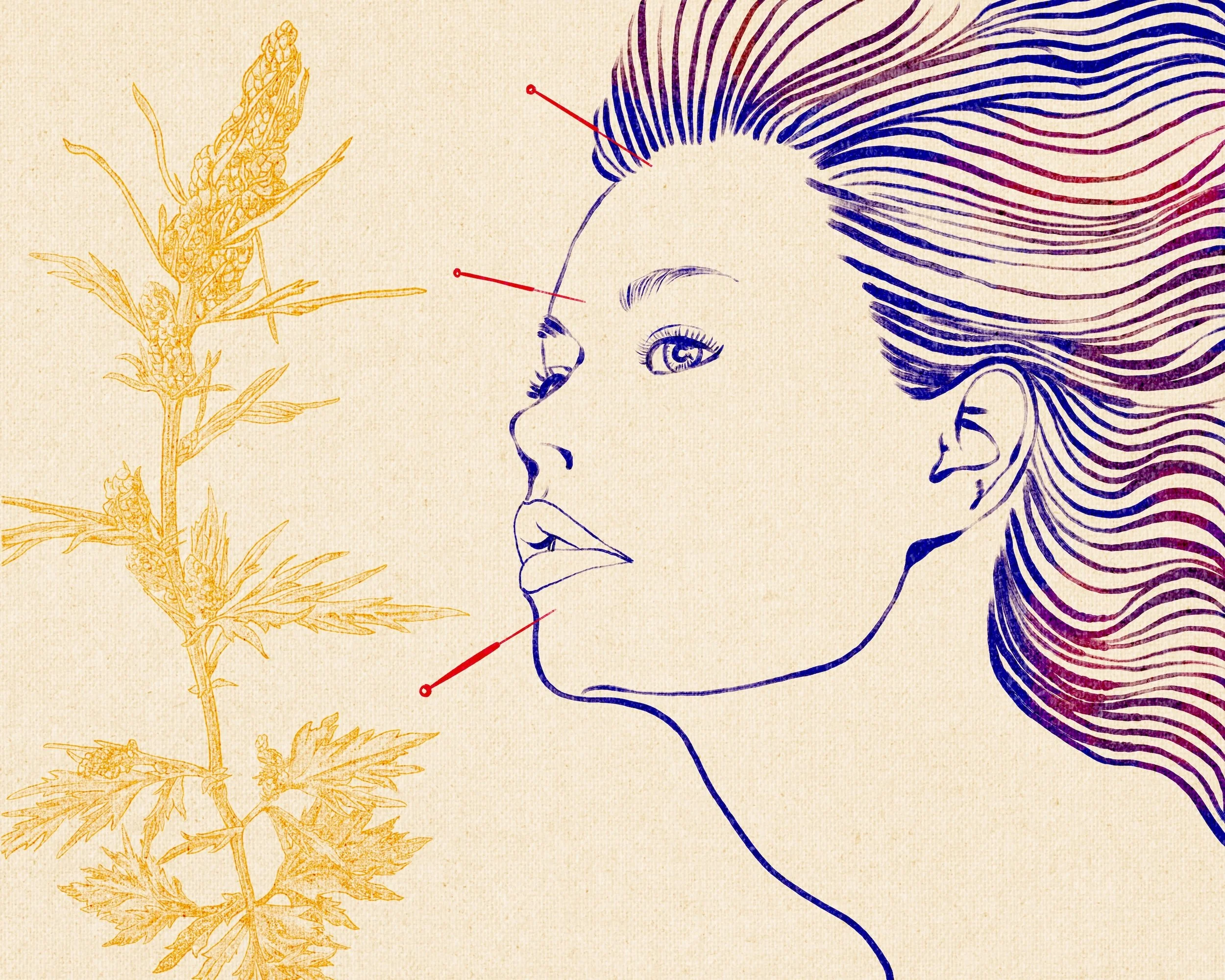 Illustration of facial acupuncture treatment